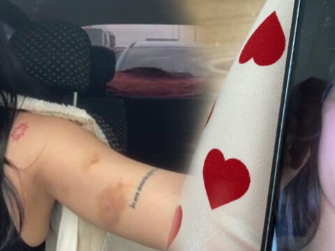 Img